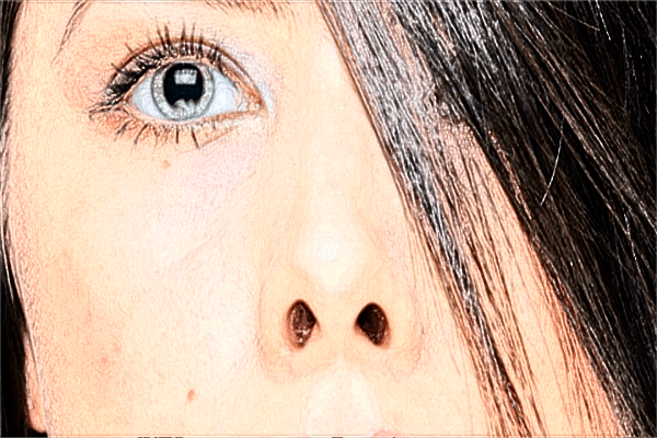 2024南昌大學(xué)第二附屬醫(yī)院祛疤價(jià)格是多少?祛疤手術(shù)能完全祛疤嗎