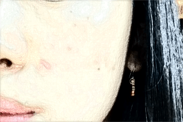 南昌大學(xué)第二附屬醫(yī)院祛斑怎么樣?2024激光祛斑需要多少錢(qián)