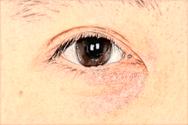 南昌大學(xué)第二附屬醫(yī)院祛斑怎么樣?2024激光祛斑需要多少錢(qián)