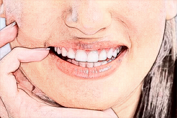 2024哈爾濱市第一醫(yī)院種植牙做的好不好_案例+價(jià)格