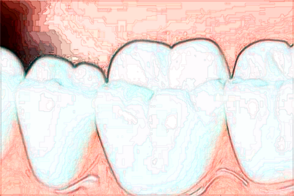 2024常州中醫(yī)醫(yī)院口腔科正畸怎么樣_那個(gè)醫(yī)生技術(shù)比較好