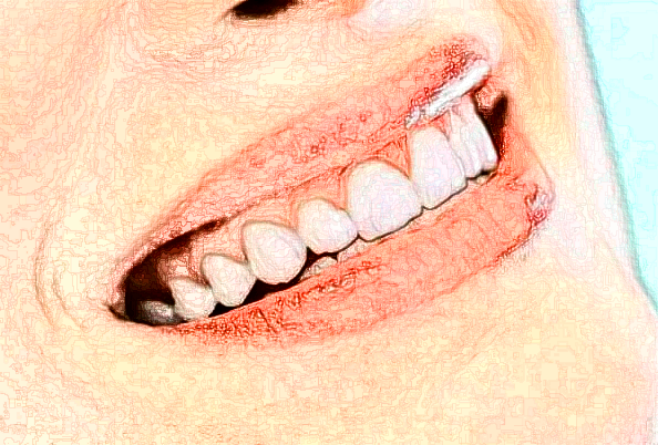 2024江蘇省口腔醫(yī)院地包天矯正做的怎么樣_哪位醫(yī)生做的不錯(cuò)