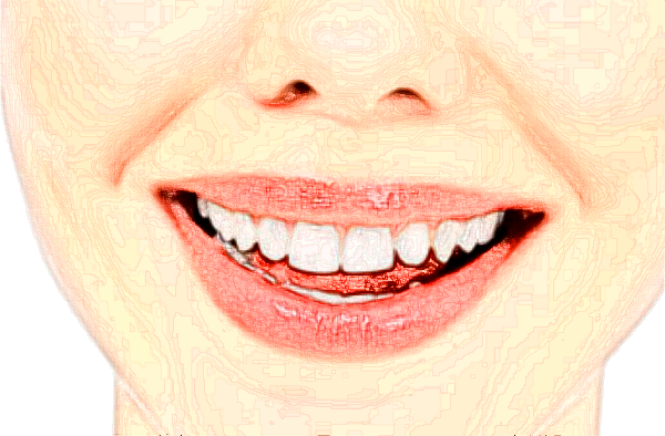 江蘇省口腔醫(yī)院隱適美怎么樣_哪個醫(yī)生做得好