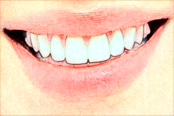 上海種植牙醫(yī)院排行榜怎么樣