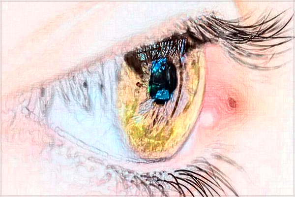 贛州市人民醫(yī)院割眼袋怎么樣?2024割眼袋價格