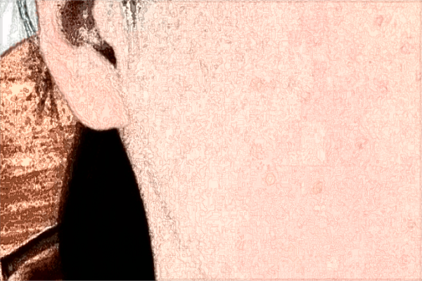 贛州市人民醫(yī)院激光祛斑好不好?2024激光祛斑的一般價(jià)格