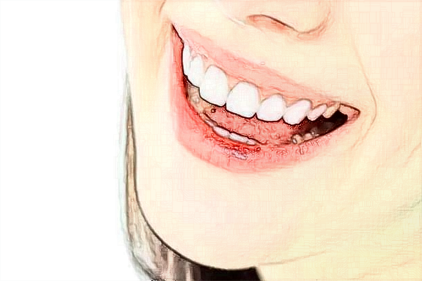 四川大學華西口腔醫(yī)院牙齒種植做的怎么樣_醫(yī)生名單推薦