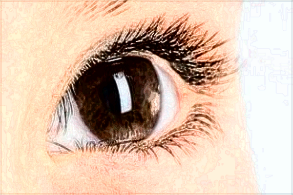 2024保定市第一中心醫(yī)院去眼袋多少錢(qián)_案例+價(jià)格分享