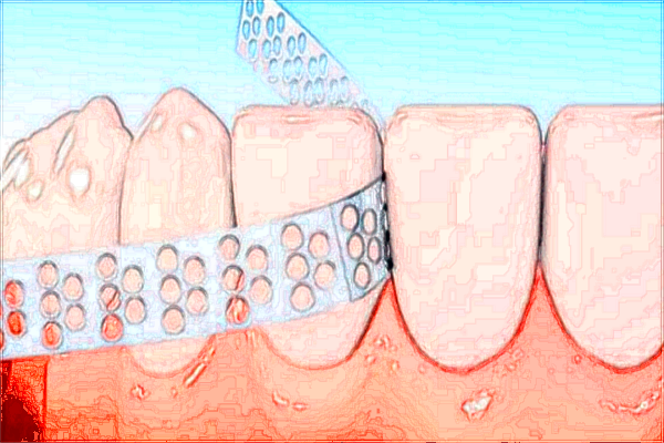 2024蘇州大學(xué)附屬第一醫(yī)院補牙做的怎么樣_哪位醫(yī)生做得好