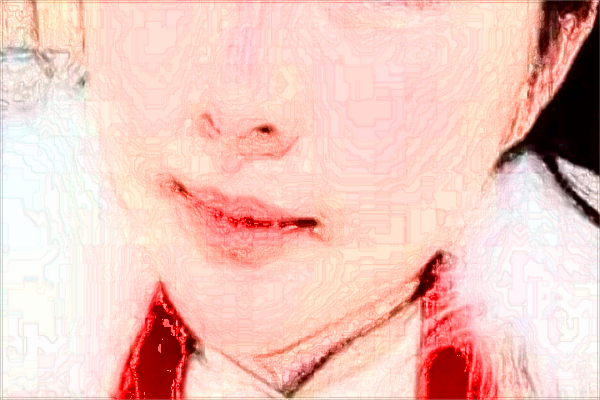 2024大連醫(yī)科大學(xué)附屬第一醫(yī)院祛痣價目表(價格表)怎么樣