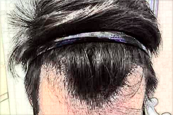 2024常州市第一人民醫(yī)院植發(fā)價目表(價格表)怎么樣