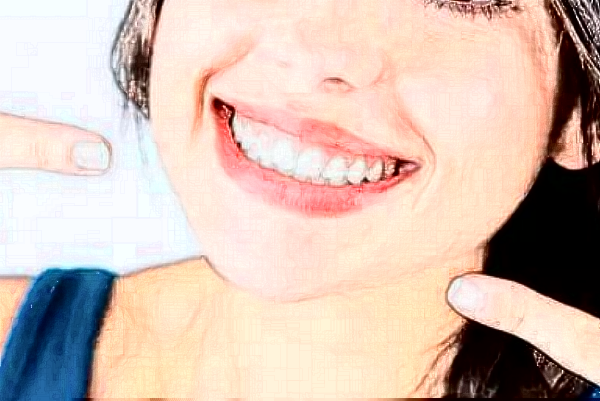 2024重慶醫(yī)科大學(xué)附屬口腔醫(yī)院補(bǔ)牙哪個(gè)醫(yī)生好_做的怎么樣