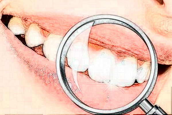 2024重慶醫(yī)科大學附屬口腔醫(yī)院鑲牙需要多少錢_案例分享