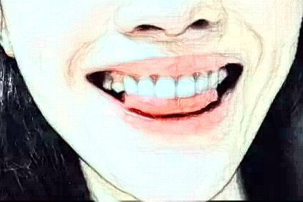 常州市第一人民醫(yī)院拔智齒需要多少錢_案例分享