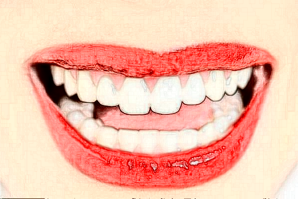 重慶醫(yī)科大學附屬口腔醫(yī)院是三甲醫(yī)院嗎？收費標準