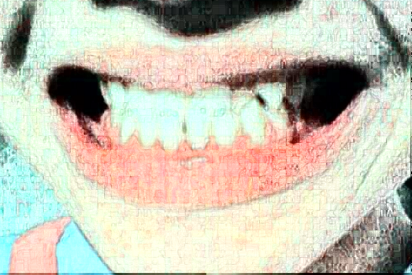 重慶醫(yī)科大學(xué)附屬口腔醫(yī)院牙齒種植怎么樣_哪個醫(yī)生做的好