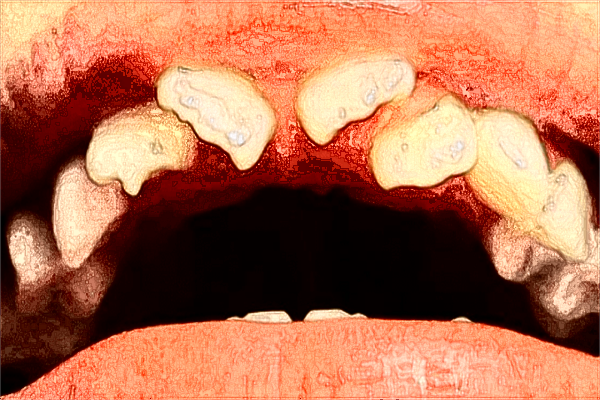 昆明市第一人民醫(yī)院口腔科怎么樣?2024口腔科費(fèi)用
