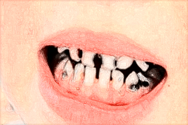 江西省口腔醫(yī)院種植牙哪個醫(yī)生好?2024種植牙醫(yī)生收費