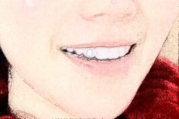 2024哈爾濱醫(yī)科大學(xué)附屬第一醫(yī)院種植牙做的怎么樣_哪位醫(yī)生比較好