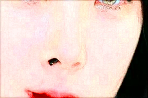 2024上海隆鼻整形醫(yī)院排名_醫(yī)院做的怎么樣