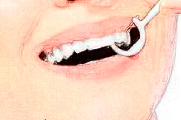 四川大學華西口腔醫(yī)院激光美容做的怎么樣_附醫(yī)生推薦