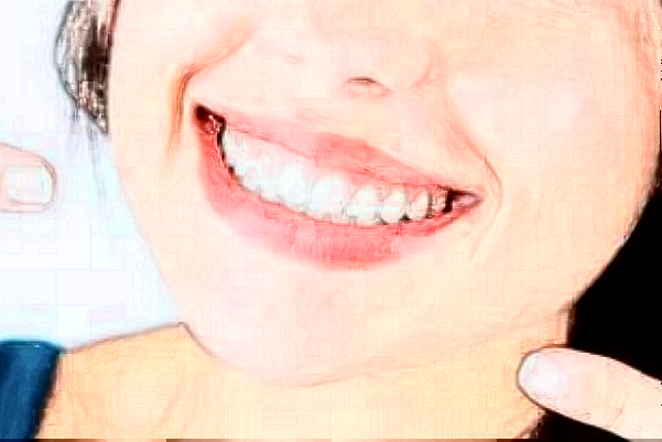 四川大學華西口腔醫(yī)院激光美容做的怎么樣_附醫(yī)生推薦