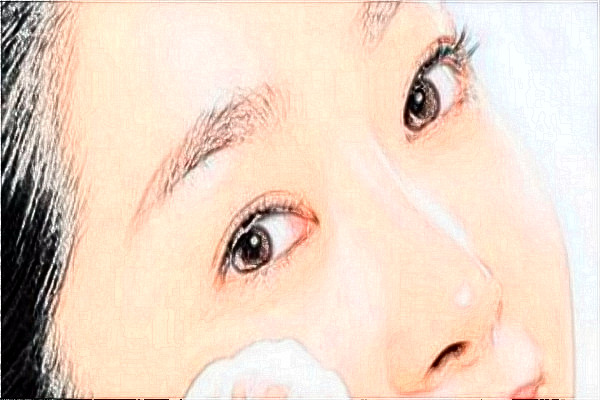 金華市中心醫(yī)院激光祛胎記做的好嗎_案例+價格