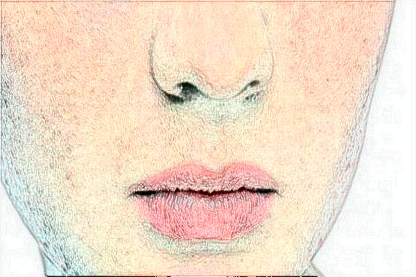 金華市中心醫(yī)院激光祛胎記做的好嗎_案例+價格