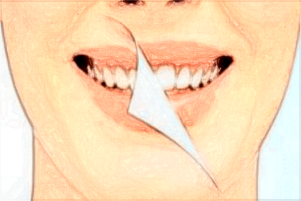 2024南昌大學(xué)第一附屬醫(yī)院根管多少錢?根管貴嗎