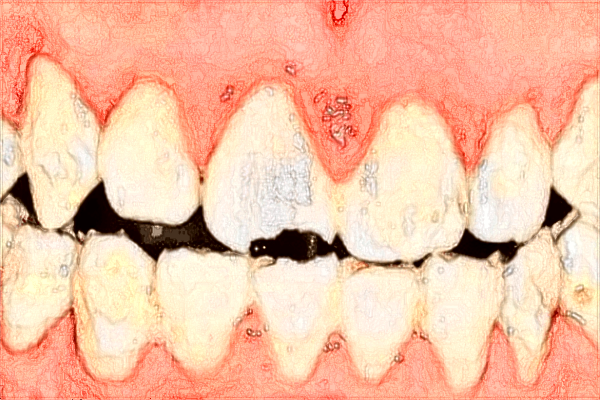青島401醫(yī)院口腔科拔牙怎么樣?2024拔牙收費價格