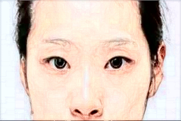 2024臺(tái)州醫(yī)院光子嫩膚做的好嗎_誰(shuí)做的比較好