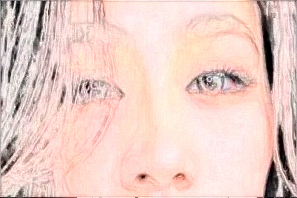 金華市中心醫(yī)院半飛秒做的好嗎_案例+價格