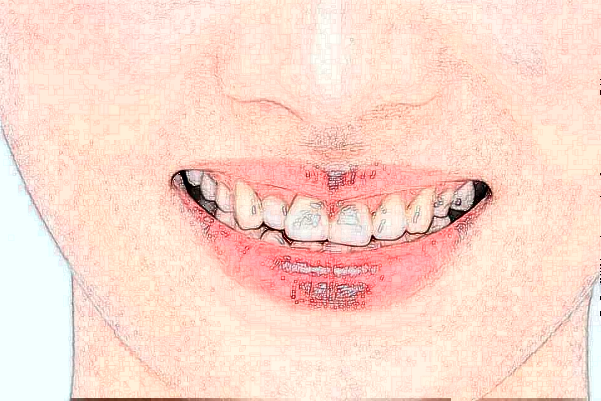 金華市中心醫(yī)院口腔科牙周價目表(價格表)怎么樣