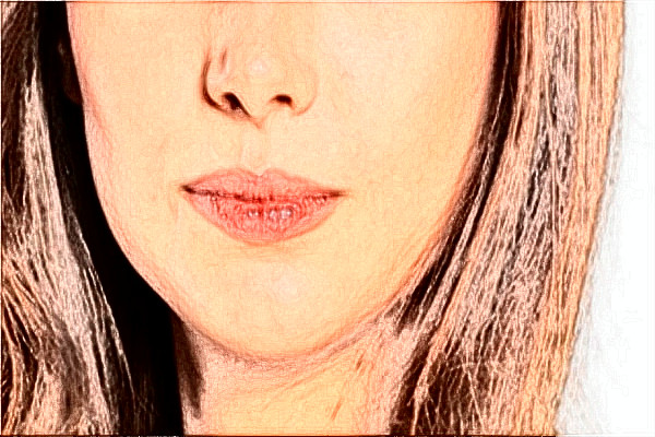 四川大學(xué)華西口腔醫(yī)院祛痣好不好_案例+價(jià)格