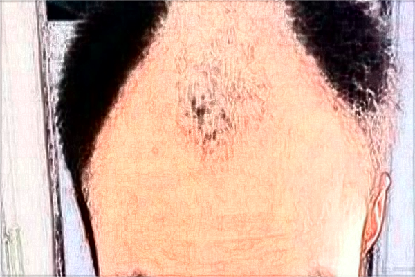 南寧303醫(yī)院植發(fā)好嗎?2024南寧303醫(yī)院植發(fā)多少錢(qián)?