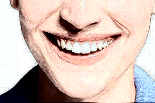 臺州醫(yī)院隱形矯正做的好嗎_誰做的比較好