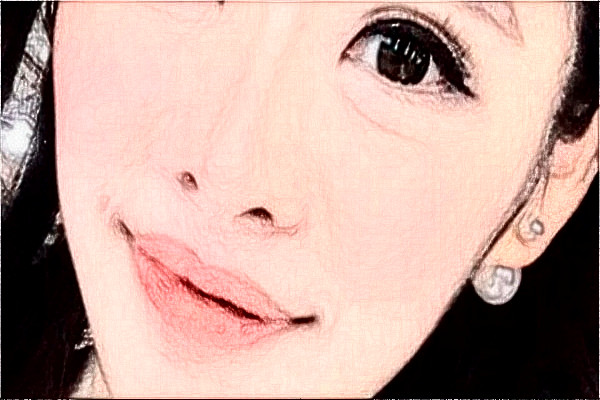 阜陽市人民醫(yī)院祛胎記做的好嗎_案例+價格