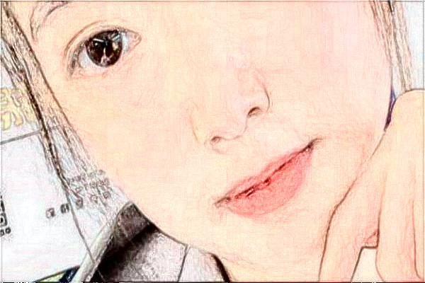 阜陽市人民醫(yī)院祛胎記做的好嗎_案例+價格