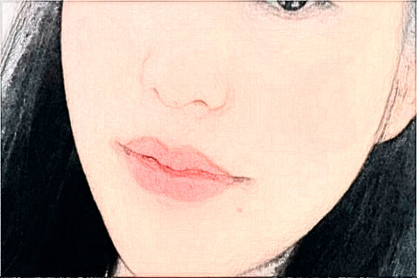 哈爾濱醫(yī)科大學附屬第一醫(yī)院去疤做的好嗎_案例+價格