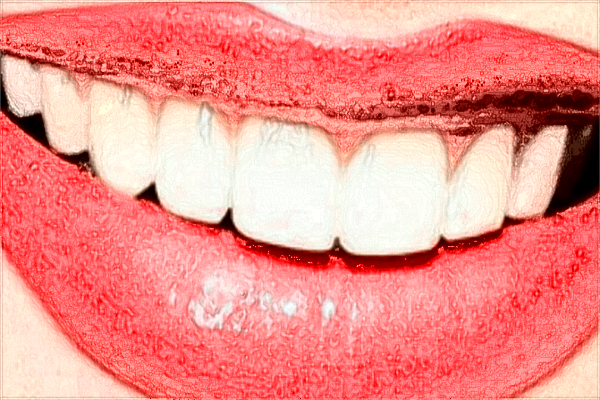 2024中山大學(xué)附屬第一醫(yī)院矯正牙齒價(jià)格?矯正牙齒要多久