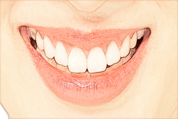 中山大學(xué)附屬口腔醫(yī)院牙齒美白哪種方法好?2024牙齒美白價(jià)格