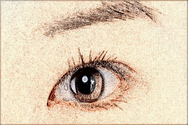 2024中山市人民醫(yī)院激光近視手術(shù)價格?激光近視手術(shù)原理