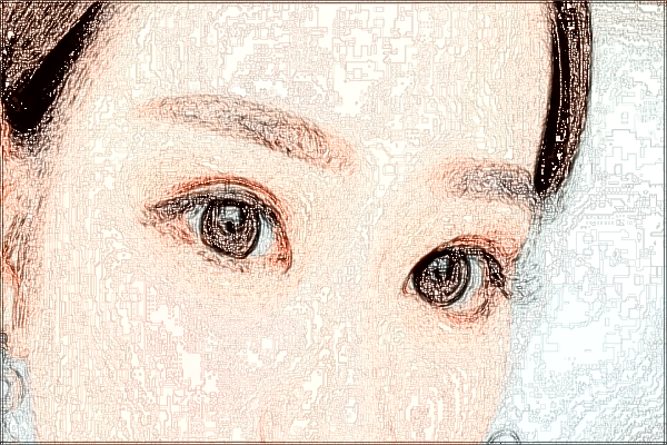 2024中山市人民醫(yī)院激光近視手術(shù)價格?激光近視手術(shù)原理