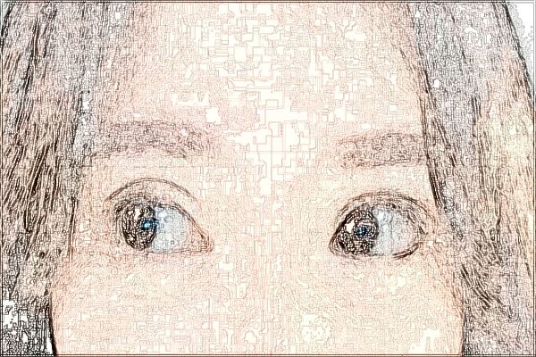 2024中山市人民醫(yī)院飛秒手術(shù)價格?飛秒手術(shù)有風(fēng)險嗎