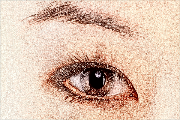 2024珠海市人民醫(yī)院去眼袋手術(shù)大概價(jià)格?去眼袋多久恢復(fù)正常