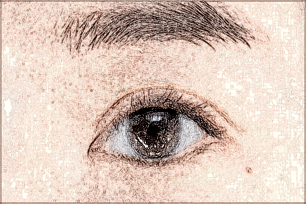 2024珠海市人民醫(yī)院去眼袋手術(shù)大概價(jià)格?去眼袋多久恢復(fù)正常