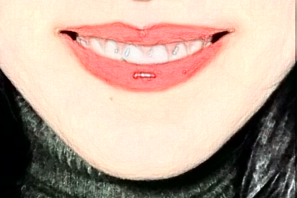 臺(tái)州醫(yī)院口腔科口腔修復(fù)做的好嗎_誰做的比較好