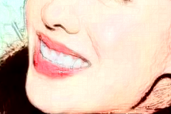 臺州醫(yī)院口腔科正頜價目表(價格表)怎么樣