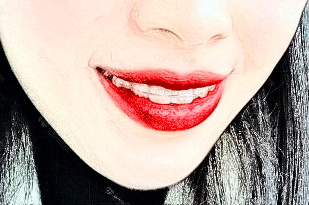 天津市第一中心醫(yī)院種植牙怎么樣_哪位醫(yī)生技術(shù)比較不錯