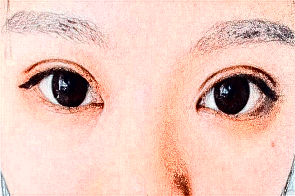 徐州市中心醫(yī)院整形美容科醫(yī)生簡介_價目表分享